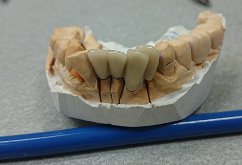 кривые зубы